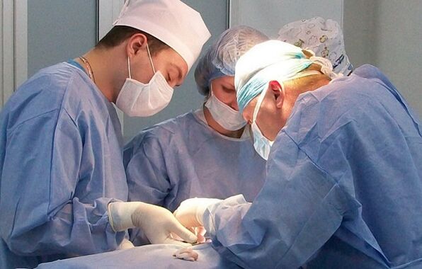 chirurgická léčba křečových žil