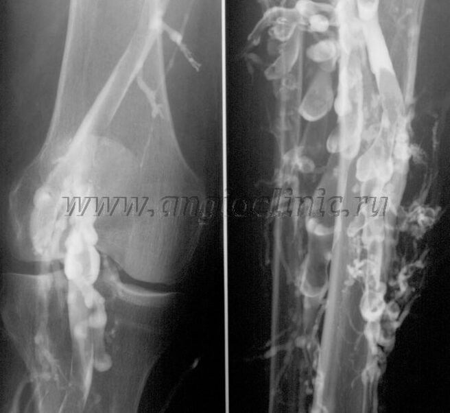 Ultrazvukové skenování